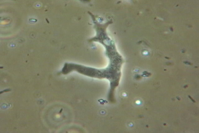 Amoeba